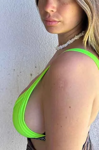 Linnea Borensberg